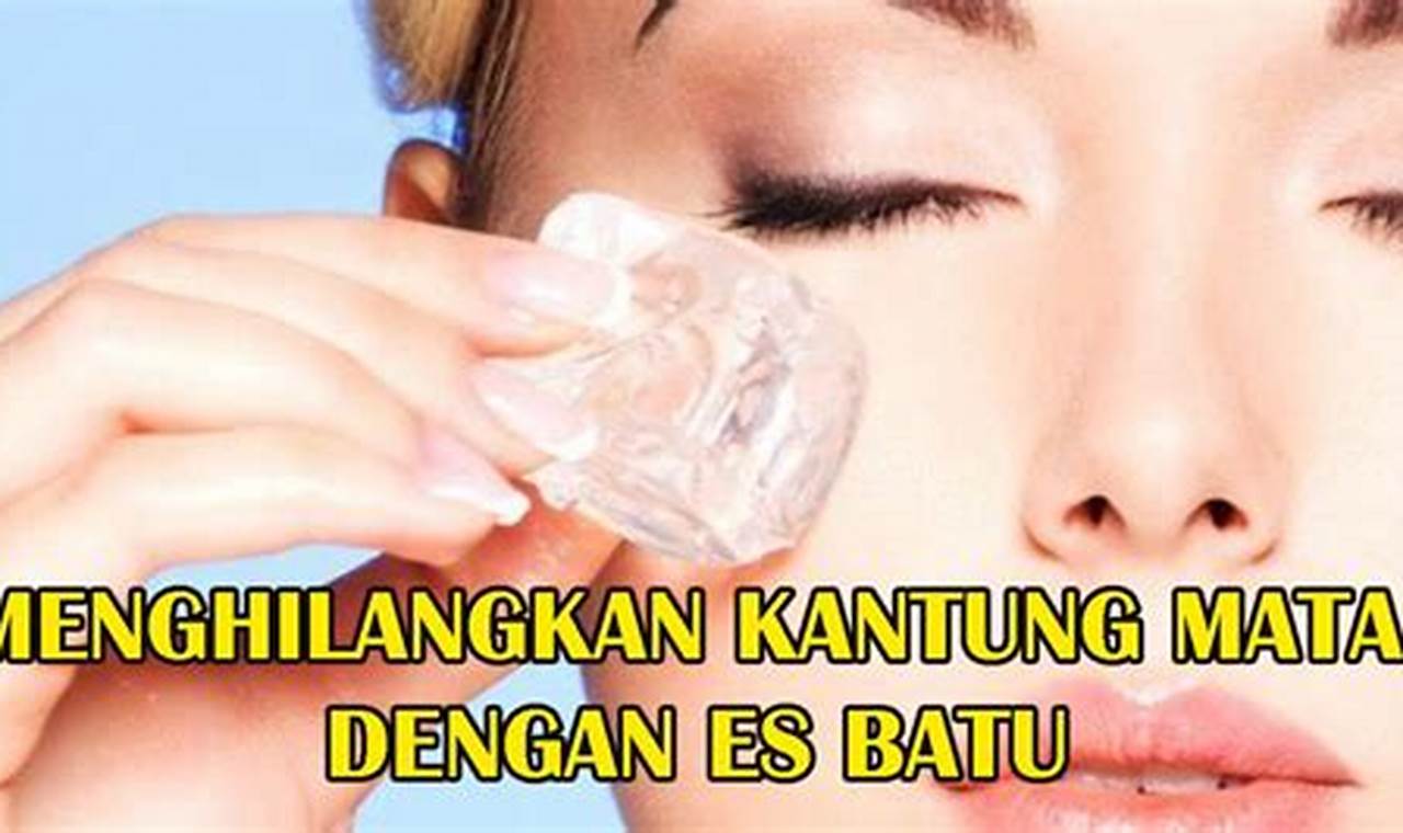 Cara Mengatasi Kantung Mata Hitam